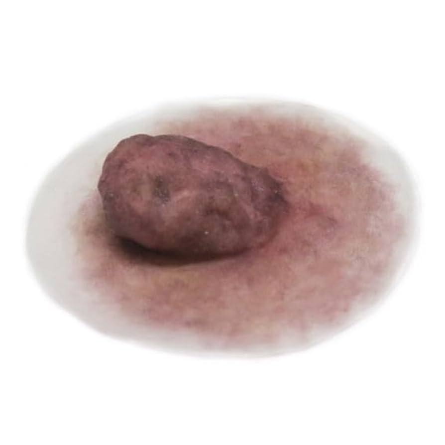 Amazon.co.jp: [ナチュラルブレスト] 人工乳首 ニップル 医療